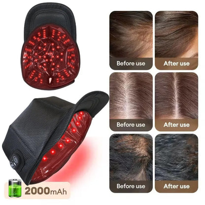 Red Light Therapy Hair Growth Cap For Hair Regrowth